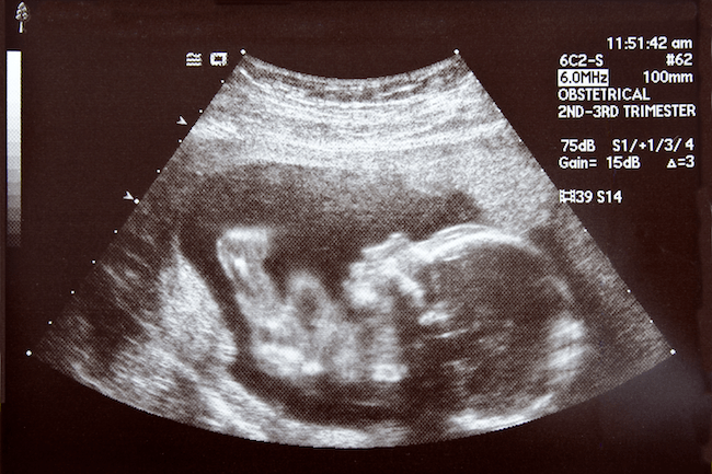 1/24/21 — Worship Exhortation: Pro-life, Pro-family, Pro-forgiveness